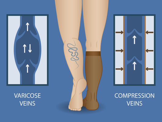 ¿Como me ayudan las calcetas de compresion?